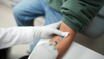Komplet badań tarczycy – dlaczego warto zadbać o pełną diagnostykę?